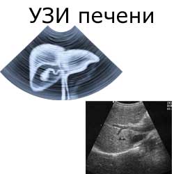 УЗИ печени