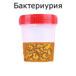 бактериурия