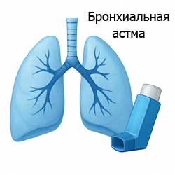 бронхиальная астма - легкие