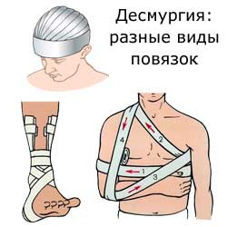 десмургия, разные виды повязок