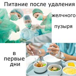 Питание после удаления желчного пузыря в первые дни