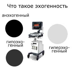 что такое эхогенность