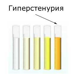 пробирки с мочой: гиперстенурия