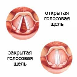открытая и закрытая голосовая щель