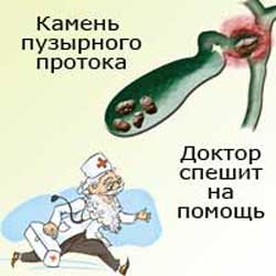 доктор спешит на помощь к пациенту с камнем пузырного протока