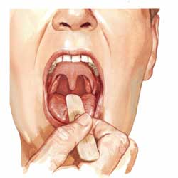 миндалины исследуют через ротовую полость