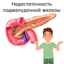 недостаточность поджелудочной железы