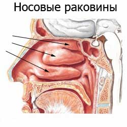 носовые раковины