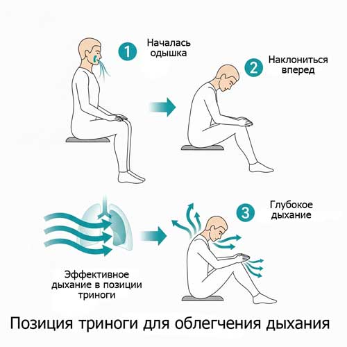 диагностика одышки