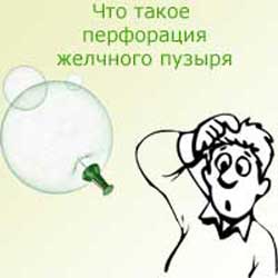 человек увидел, что такое перфорация желчного пузыря