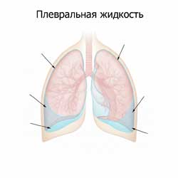 грудная клетка, легкие и плевральная жидкость