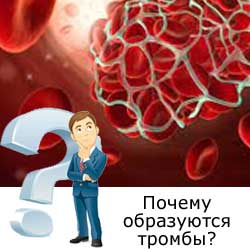 человек спрашивает почему образуются тромбы