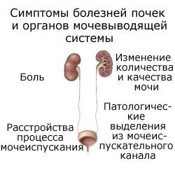 Симптомы болезней почек и органов мочевыводящей системы, четыре группы