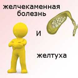 человек у которого желчнокаменная болезнь и желтуха