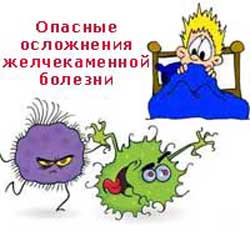 опасные осложнения желчнокаменной болезни