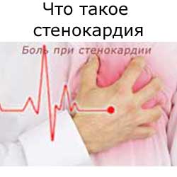что такое стенокардия