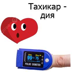 тахикардия