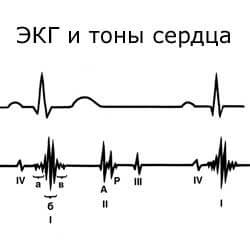 ЭКГ и тоны сердца
