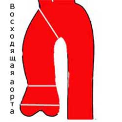 восходящий отдел аорты