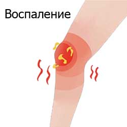 воспаление
