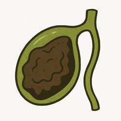 замазкообрзная желчь в желчном пузыре