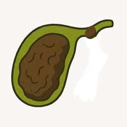 камень перекрыл желчный проток